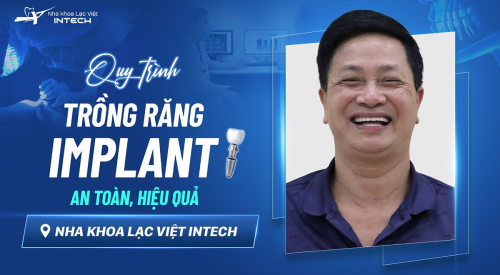 Quy trình trồng răng Implant chuẩn y Nha khoa Lạc Việt Intech