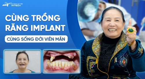 Cùng trồng răng Implant, cùng sống đời viên mãn