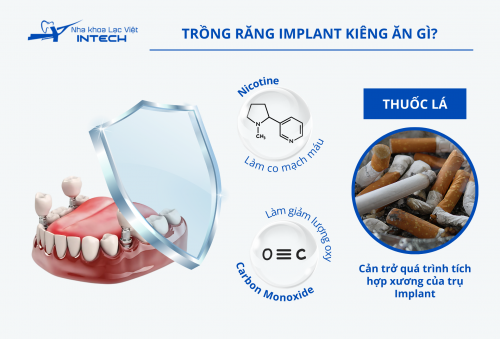 Trồng răng Implant kiêng ăn gì? 3 chế độ ăn giúp răng Implant khỏe mạnh