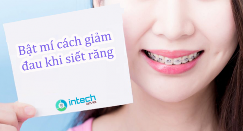 TÌM HIỀU VỀ QUÁ TRÌNH SIẾT RĂNG KHI NIỀNG LÀ GÌ?