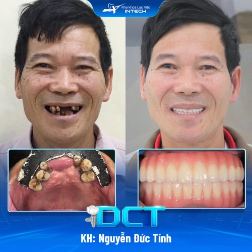 KH: Nguyễn Đức Tính