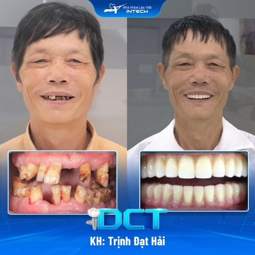 KH: Trịnh Đạt Hải