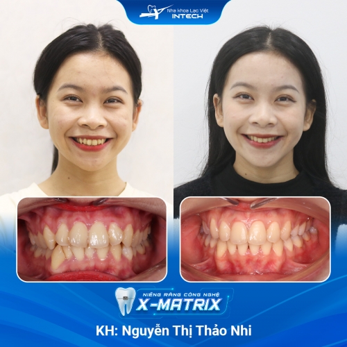 Nguyễn Thị Thảo Nhi