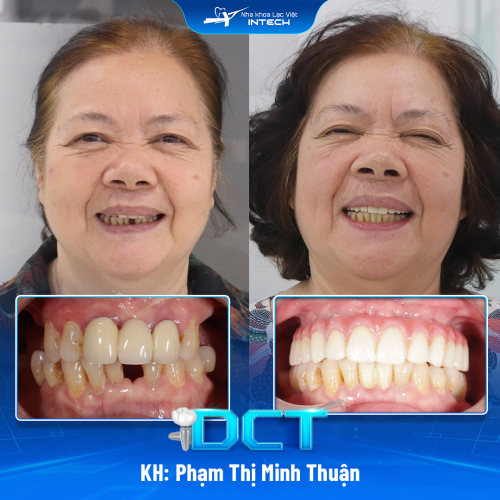 KH: Phạm Thị Minh Thuận