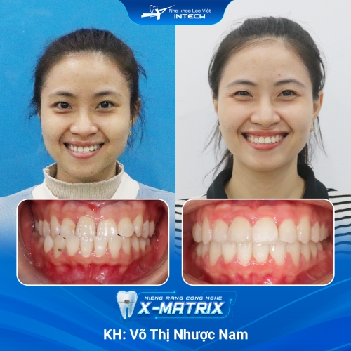 Võ Thị Nhược Nam