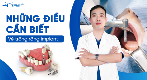 Trồng răng Implant là gì? Quy trình trồng răng Implant diễn ra như thế nào?