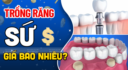 Giá trồng răng sứ là bao nhiêu? Cập nhật bảng giá tại Lạc Việt Intech 2023