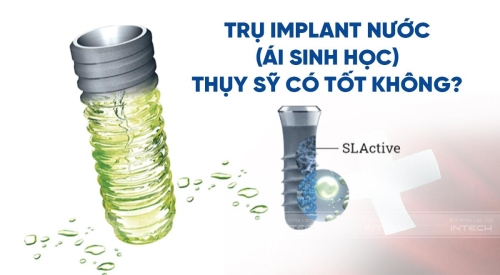 Trụ Implant nước (ái sinh học) Thụy Sĩ là gì? Có tốt không?  