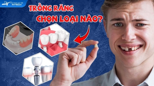 3 phương pháp trồng răng giả phổ biến hiện nay