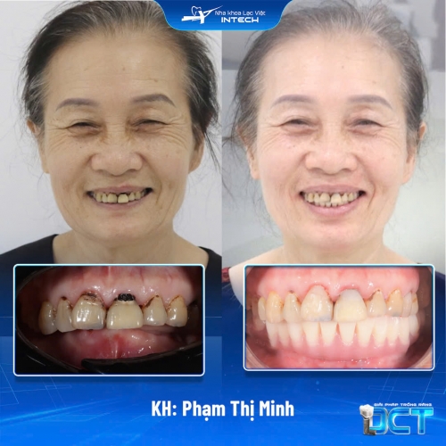 KH: Phạm Thị Minh