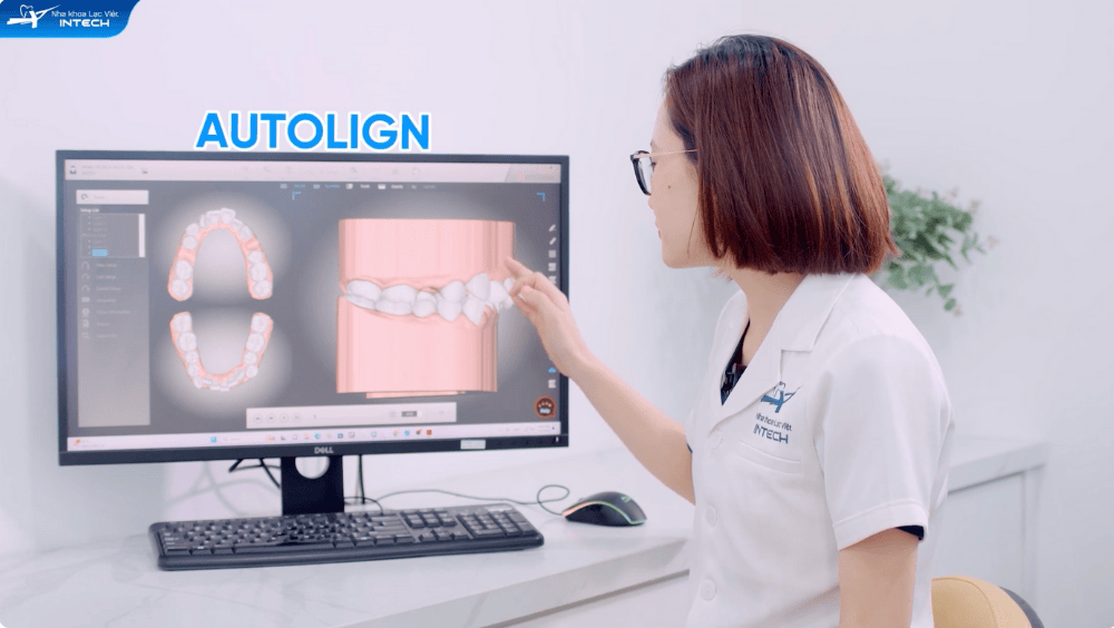 Công nghệ hiện đại trong niềng răng