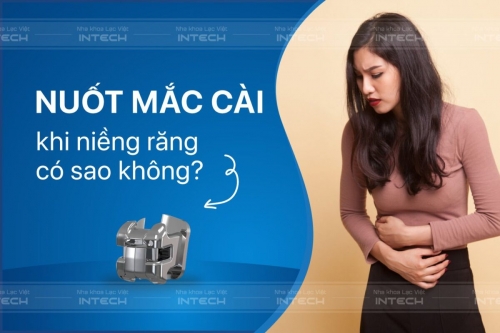 Góc hỏi đáp: nuốt mắc cài khi niềng răng ảnh hưởng gì không?