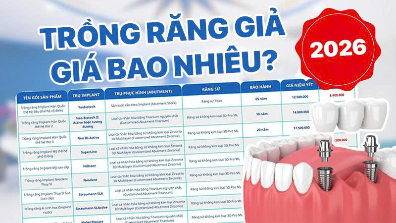 Trồng Răng Giả Giá Bao Nhiêu Tiền? Cập Nhật Bảng Giá Trồng Răng Mới Nhất 2026