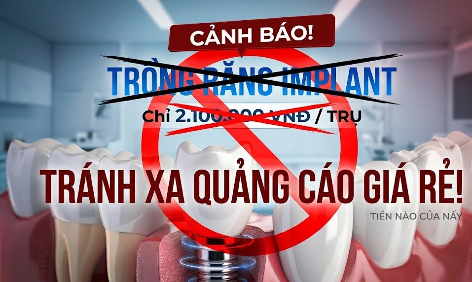 Cẩn trọng với những quảng cáo trồng răng giá rẻ