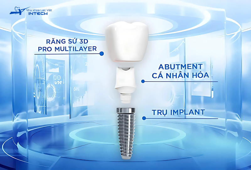 Trụ Implant và răng sứ được sử dụng để phục hồi thẩm mỹ, không phải để điều trị các bệnh lý nguy hiểm khác nên không được bảo hiểm y tế chi trả