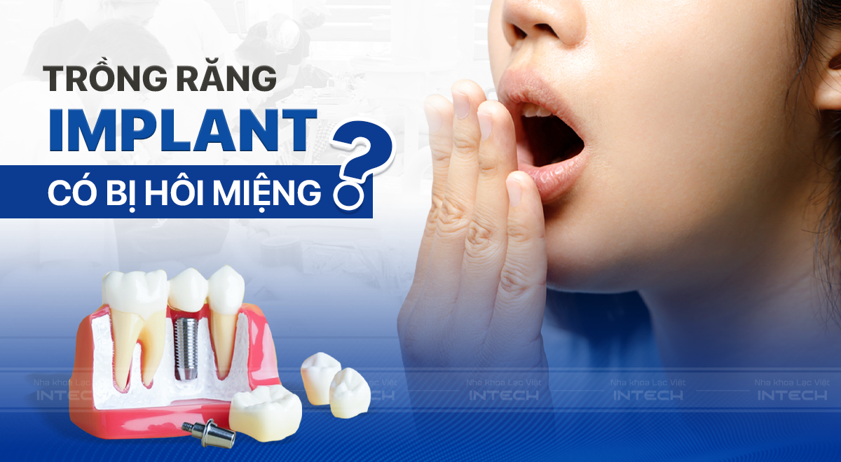 Trồng răng giả liệu có bị hôi miệng không? 