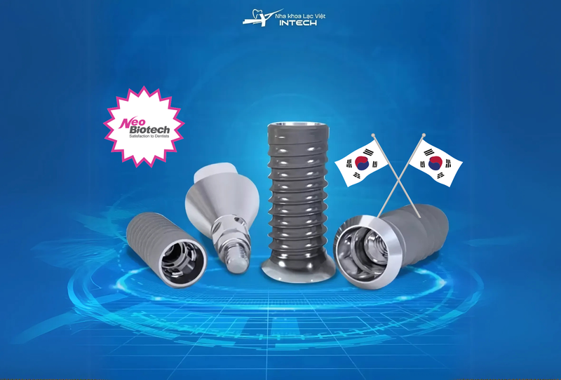 So với các thương hiệu Implant đến từ những quốc gia khác, Implant Hàn Quốc có mức giá thấp hơn, phù hợp với mức sống của người châu Á