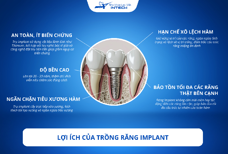 Trồng răng Implant là giải pháp phục hình răng mất tốt nhất hiện nay với nhiều lợi ích vượt trội, khắc phục hạn chế của những phương pháp khác