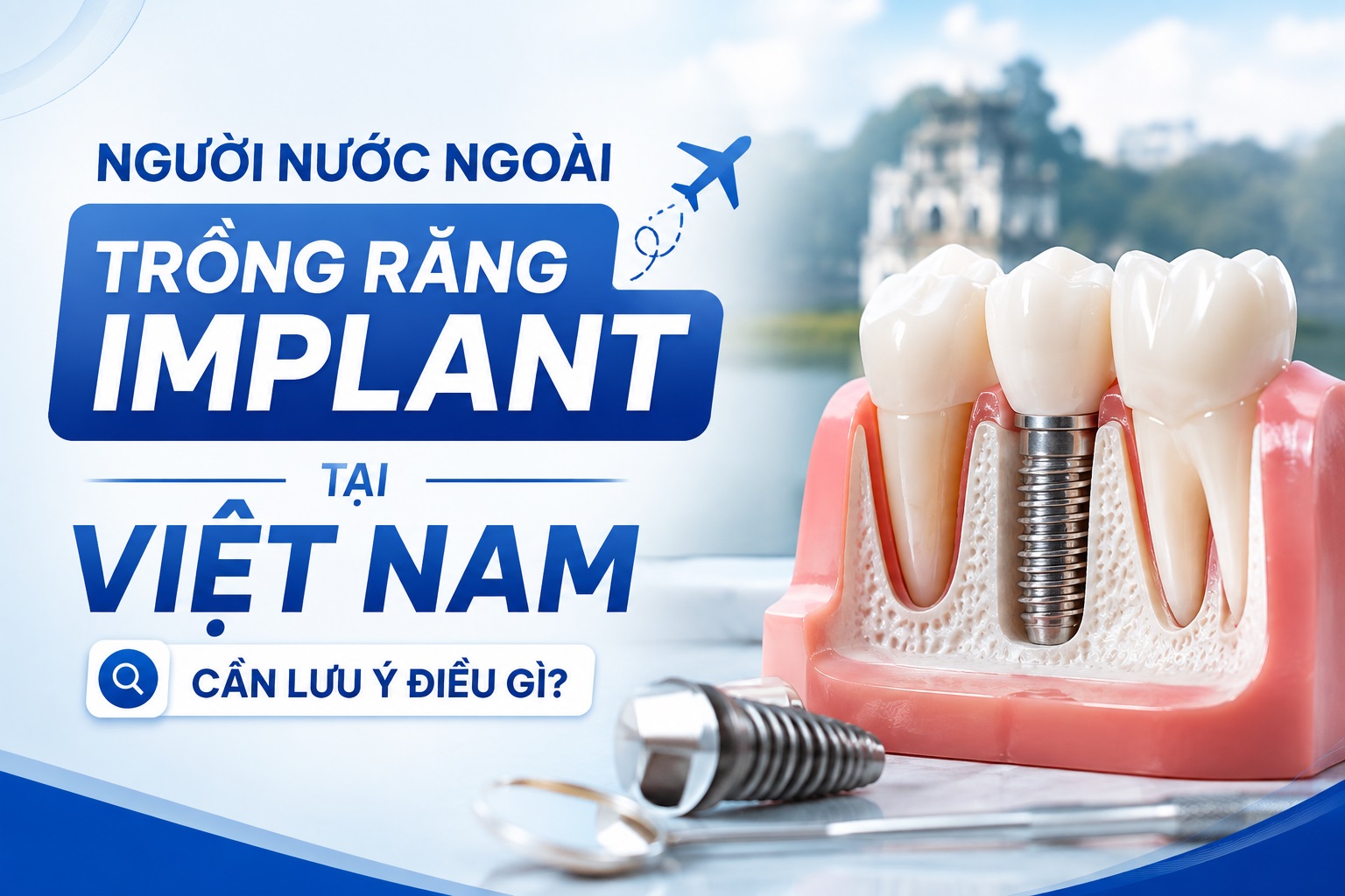 Trồng răng Implant tại Việt Nam: Người nước ngoài nên chọn trụ như thế nào?