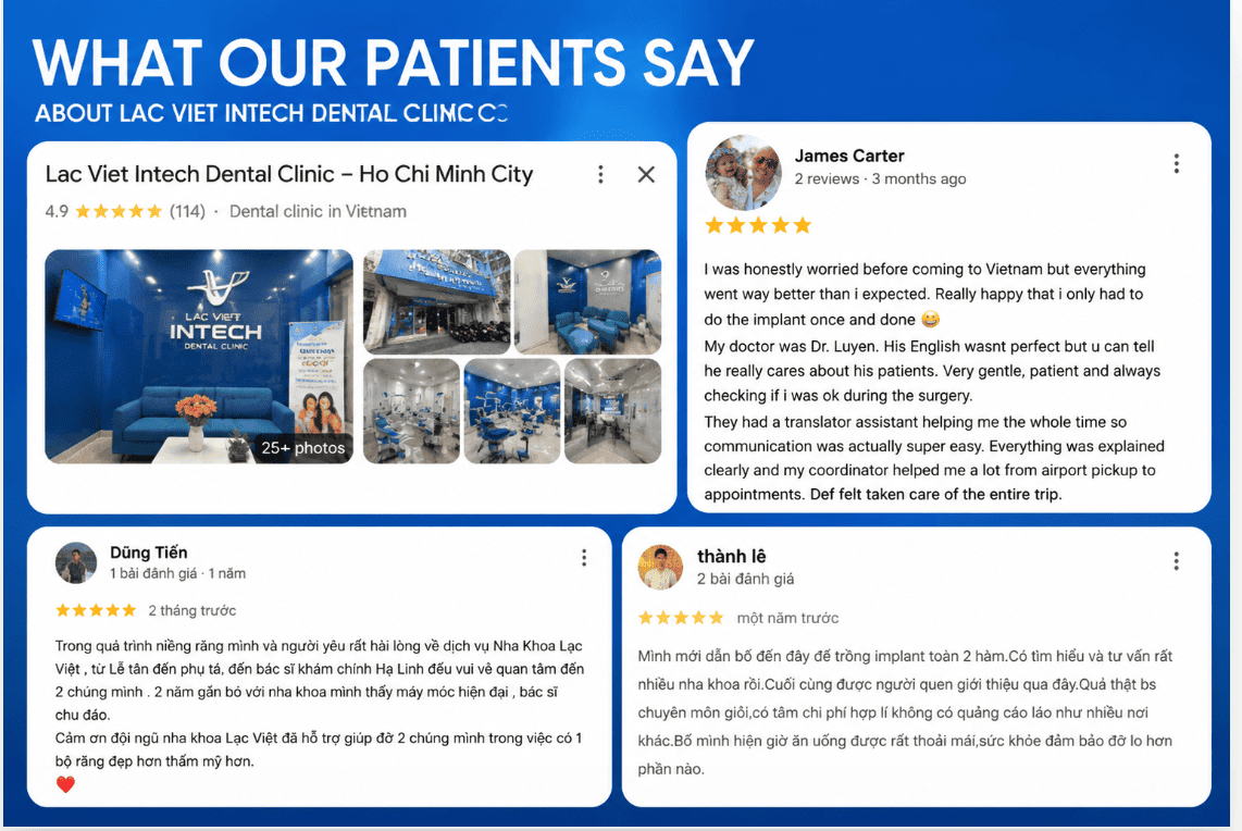 Lac Viet Intech is the best dental implant clinic, chosen by many customers.
