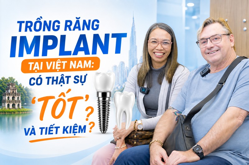 Trồng răng implant tại Việt nam: Có thật sự tốt và tiết kiệm?