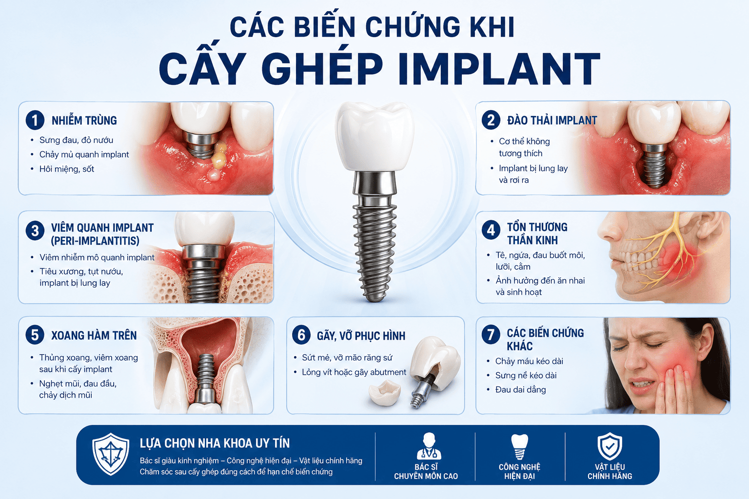 các loại biến chứng khi trồng răng tại việt nam
