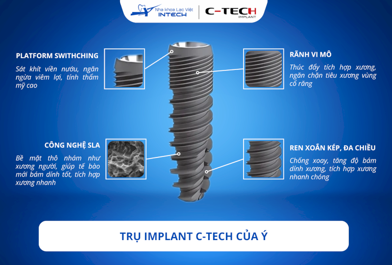 Trụ Implant của Ý C-Tech: Cấu tạo, ưu điểm & chi phí