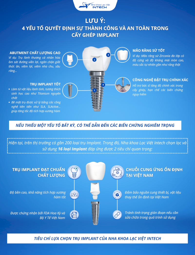 Những lưu ý quan trọng cần quan tâm khi lựa chọn nơi trồng Implant
