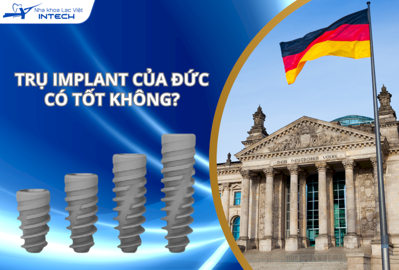 Trụ Implant của Đức có tốt không? 3+ dòng trụ Implant Đức chất lượng cao