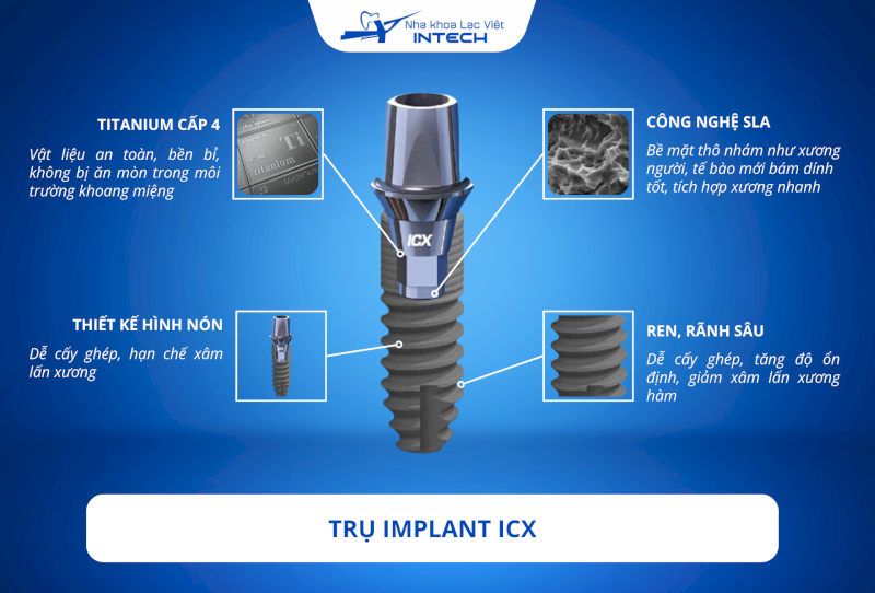 Trụ Implant ICX có chất lượng đảm bảo trong tầm giá hợp lý