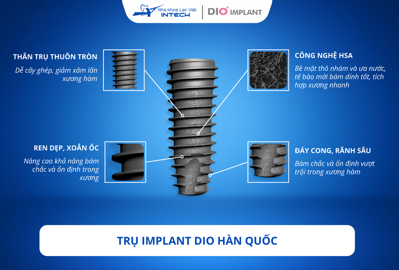 Trụ Dio ứng dụng nhiều cải tiến độc quyền của hãng, giúp tăng khả năng tích hợp xương nhưng chưa phân phối rộng rãi tại Việt Nam