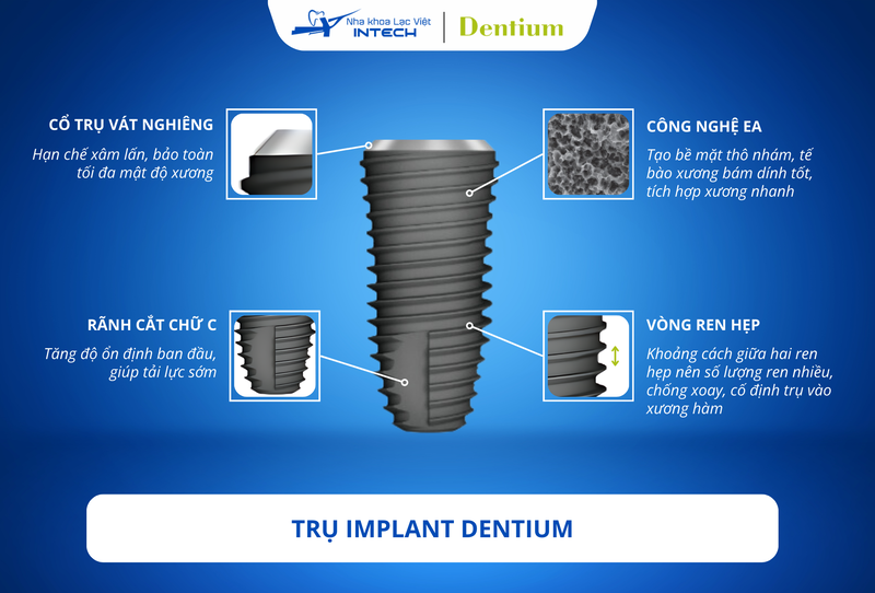 Trụ Implant Dentium có thiết kế tăng cường khả năng tích hợp xương mà vẫn đảm bảo tính thẩm mỹ