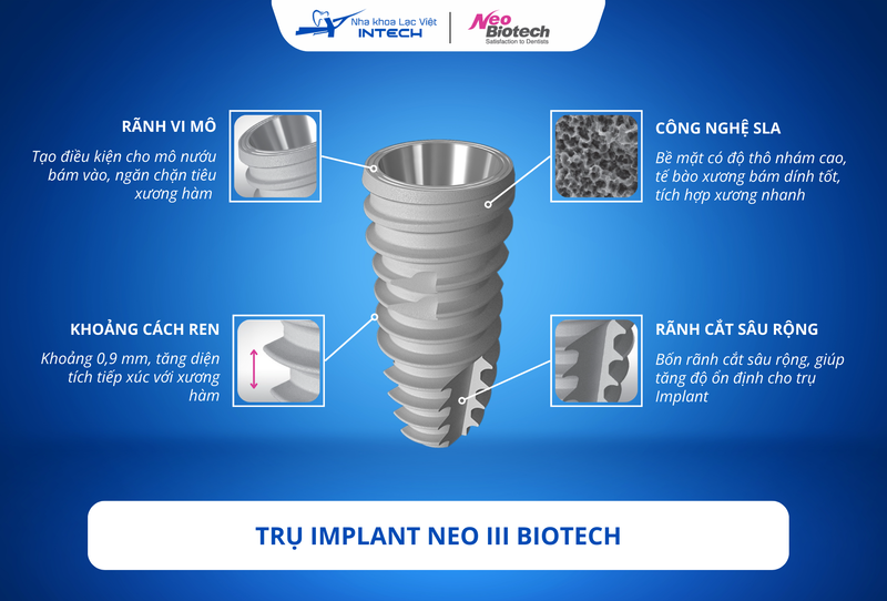 Trụ Implant Neo III Biotech được cải tiến thiết kế, chất lượng và ứng dụng công nghệ vượt trội, nâng cao tỷ lệ cấy ghép thành công và lâu dài