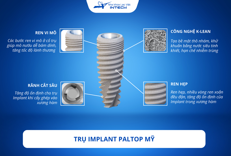 Trụ Paltop ứng dụng nhiều công nghệ tiên tiến cho khả năng tích hợp xương tốt, kháng khuẩn vượt trội