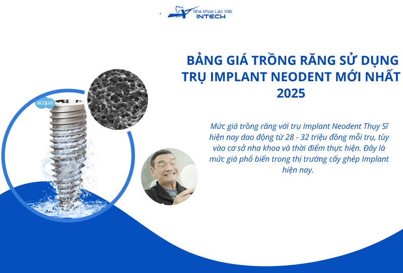 Mức giá trồng răng với trụ Implant Neodent Thụy Sĩ tùy vào cơ sở nha khoa và thời điểm thực hiện