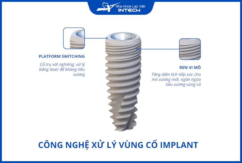 Công nghệ xử lý vùng cổ tốt đảm bảo độ bền của implant.