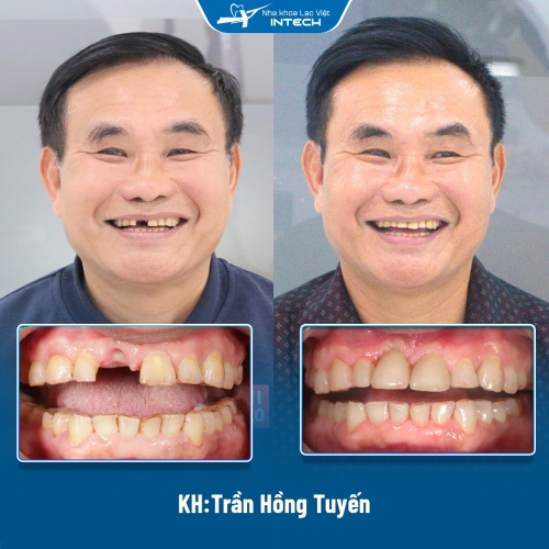 KH: Trần Hồng Tuyến