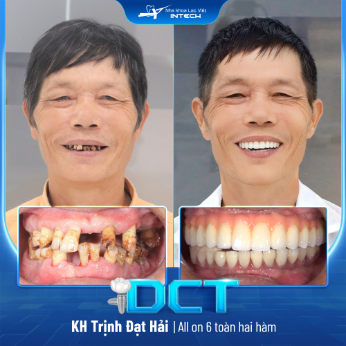 KH: Trịnh Đạt Hải