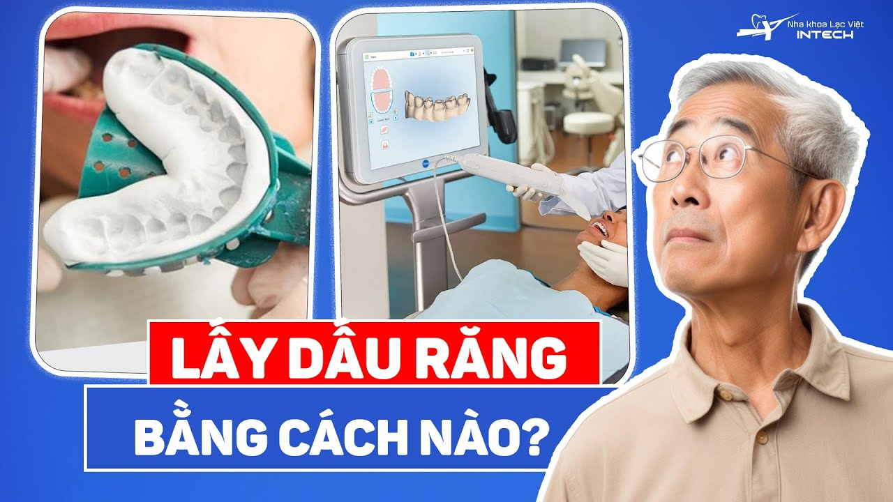 Tùy vào từng nha khoa mà lấy dấu răng bằng cách thức truyền thống hay sử dụng công nghệ scan để lấy dấu răng