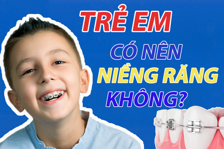 Trẻ em có nên niềng răng không? 