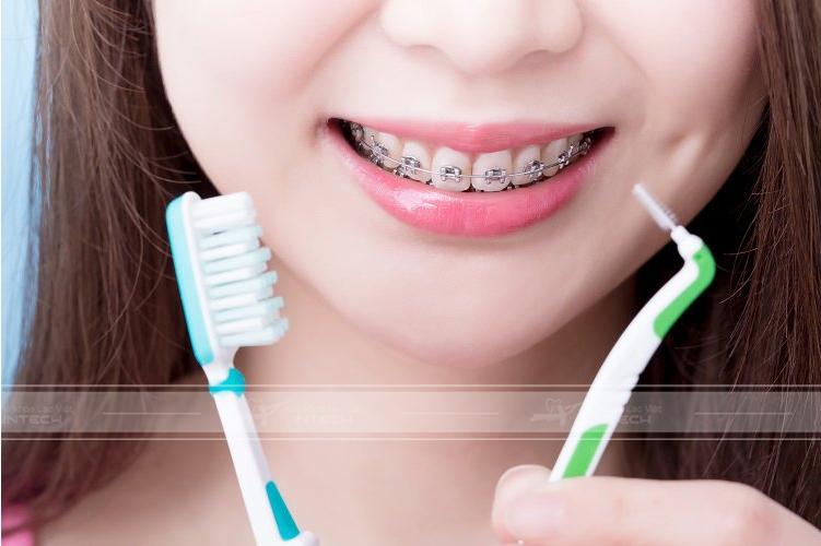 Vệ sinh răng miệng sạch sẽ để niềng răng hiệu quả hơn