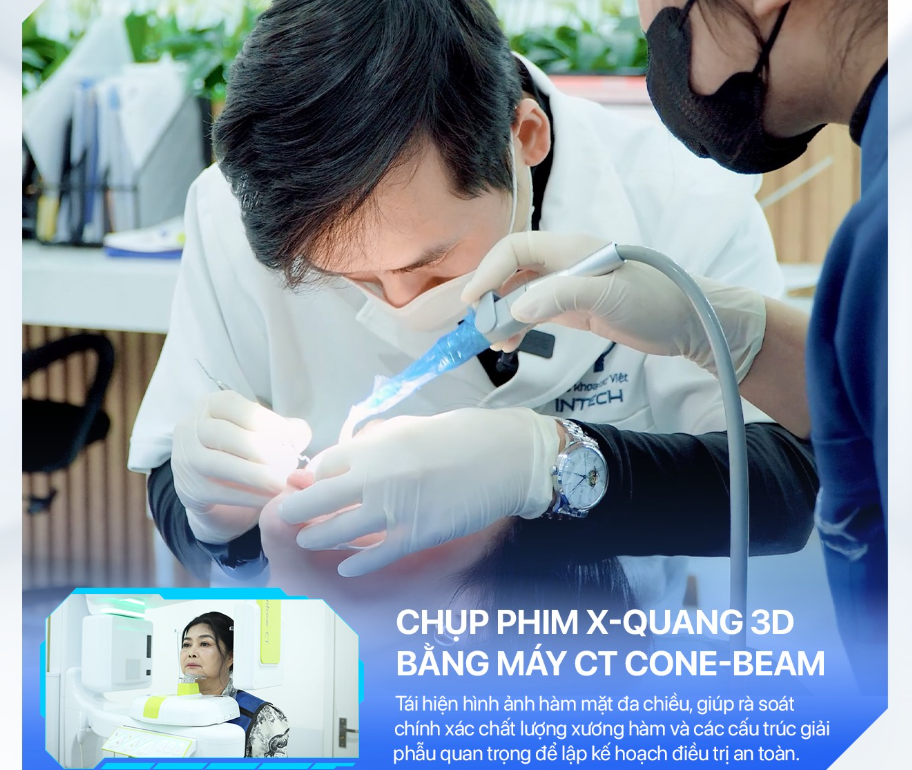 Nha khoa Lạc Việt Intech Tphcm trang bị đầy đủ các thiết bị chẩn đoán hình ảnh hiện đại như CT Conbeam