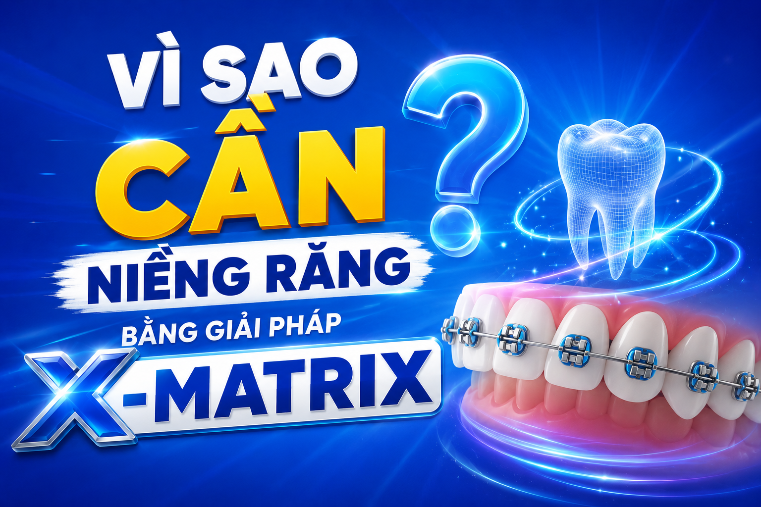 Vì sao cần niềng răng bằng giải pháp X-matrix: Kế hoạch niềng răng quyết định toàn bộ kết quả điều trị?