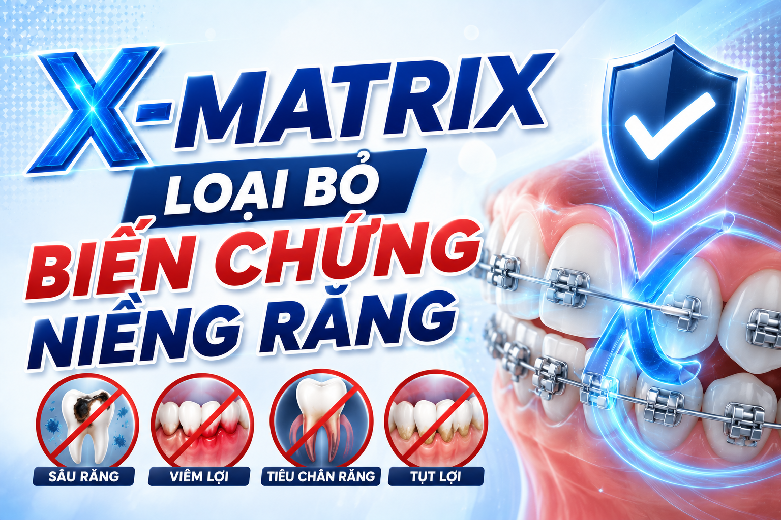 Biến chứng khi niềng răng: X-Matrix đã giải quyết như thế nào?