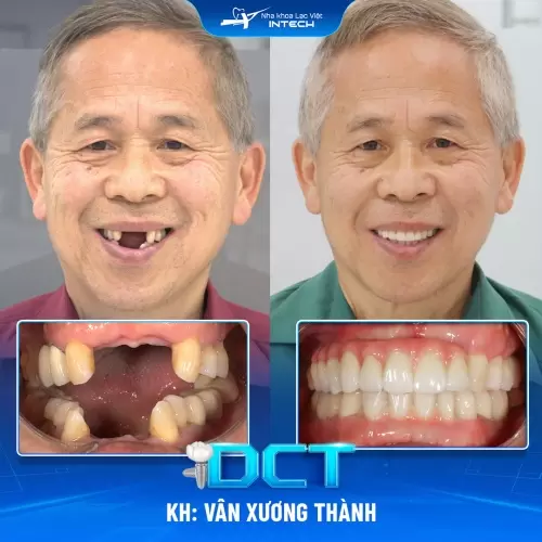 Case Image